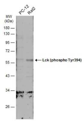 Western Blot: Lck [p Tyr394] Antibody [NBP3-13305]